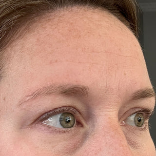 BTBS Fine Lines Regimen Page | B+A Tile 1 Image File [Before]