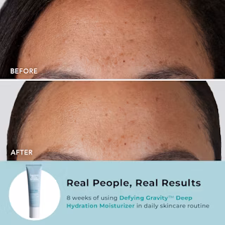 BTBS Deep Hydration Moisturizer Gallery B+A Image 1